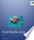 Cover of: Maxillectomy a review