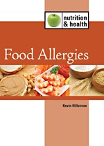 Cover of: Food allergies