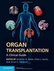 Cover of: Organ transplantation by Andrew Klein