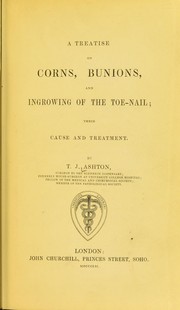 Cover of: A treatise on corns, bunions, and ingrowing of the toe-nail: their cause and treatment
