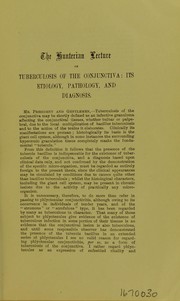 Cover of: The Hunterian Lecture on tuberculosis of the conjunctiva: its etiology, pathology, and diagnosis