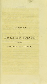 Cover of: An essay on a new mode of treatment for diseased joints by Thomas Buchanan