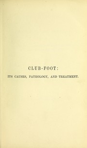 Cover of: Club-foot: its causes, pathology and treatment