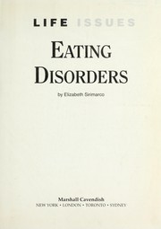 Cover of: Eating disorders by Elizabeth Sirimarco