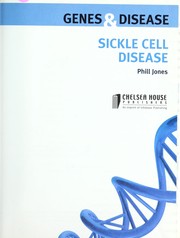 Sickle cell disease by Phill Jones