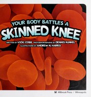 Cover of: Your body battles a skinned knee by 