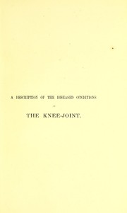 A description of the diseased conditions of the knee-joint which require amputation of the limb, and those conditions which are favourable to excision of the joint by P. C. Price