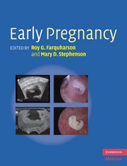 Cover of: Early pregnancy by Roy G. Farquharson, Mary D. Stephenson