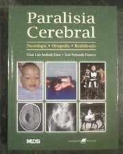 Cover of: Paralisia cerebral by César Luiz Ferreira de Andrade Lima