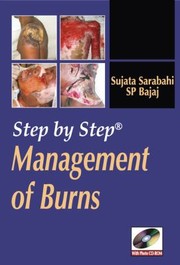 Cover of: Step By Step Management Of Burns