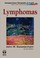 Cover of: Lymphomas