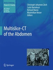 Multislicect Of The Abdomen by Christoph Johannes Zech