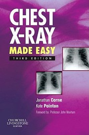 Cover of: Chest Xray Made Easy