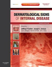 Cover of: Dermatological Signs Of Internal Disease by 