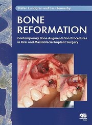 Cover of: Bone Reformation Contemporary Bone Augmentation Procedures In Oral And Maxillofacial Implant Surgery by 