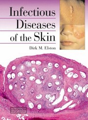 Cover of: Infectious Diseases Of The Skin by Dirk M. Elston