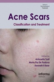 Cover of: Acne Scars Classification And Treatment by 