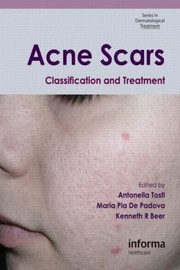 Acne Scars Classification And Treatment by Antonella Tosti