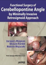 Cover of: Functional Surgery Of Cerebellopontine Angle By Minimally Invasive