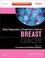 Cover of: Breast Cancer