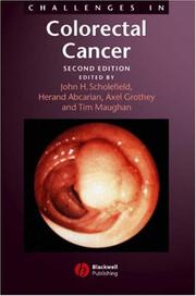 Cover of: Challenges in Colorectal Cancer by Herand Abcarian, Axel Grothey, Tim Maughan