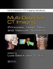Multidetector Ct Imaging by Luca Saba