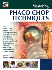 Cover of: Mastering Phaco Chop Techniques by Ashok Garg