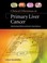 Cover of: Clinical Dilemmas In Primary Liver Cancer