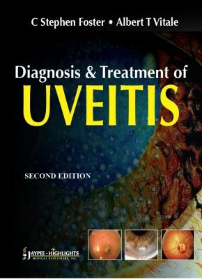 Diagnosis And Treatment Of Uveitis by 