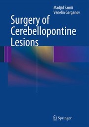 Cover of: Surgery Of Cerebellopontine Lesions by Madjid Samii