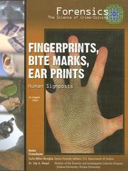 Cover of: Fingerprints, bite marks, ear prints: human signposts