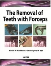 Cover of: Removal Of Teeth With Forceps The by Robin W. Matthews