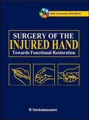 Cover of: Surgery Of The Injured Hand Towards Functional Restoration