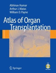 Cover of: Atlas Of Organ Transplantation