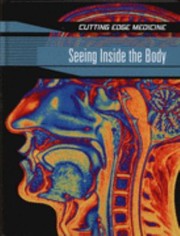 Cover of: Seeing Inside the Brain
            
                Cutting Edge Medicine by 