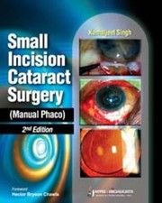 Small Incision Cataract Surgery Manual Phaco