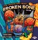 Cover of: Your Amazing Body Mends A Broken Bone
