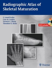 Radiographic Atlas Of Skeletal Maturation by Christopher Gaskin