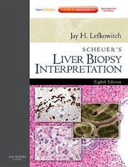 Cover of: Scheuers Liver Biopsy Interpretation 9e Expert Consult by Jay H. Lefkowitch