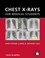 Cover of: Chest Xrays For Medical Students