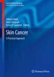 Cover of: Skin Cancer A Practical Approach