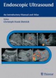 Cover of: Endoscopic Ultrasound An Introductory Manual And Atlas 94 Tables