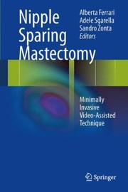Cover of: Nipple Sparing Mastectomy Minimally Invasive Videoassisted Technique