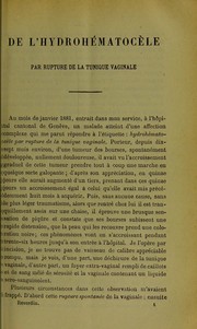 Cover of: De l'hydroh©♭matoc©·le par rupture de la tunique vaginale