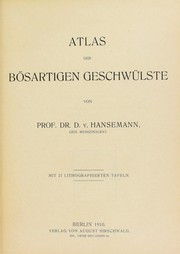 Cover of: Atlas der b©œsartigen Geschw©ơlste