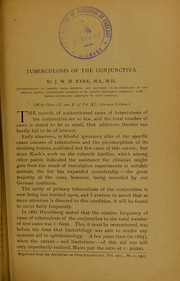 Cover of: Tuberculosis of the conjunctiva