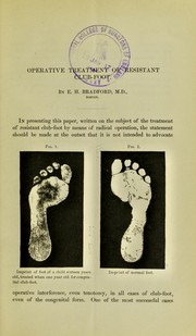 The operative treatment of resistant club-foot by Edward Hickling Bradford