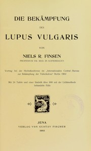 Cover of: Die Bek©Þmpfung des Lupus vulgaris
