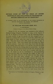 Cover of: Severe burn of top of head at seven months of age, followed by necrosis of entire osseous cap of cranium by William W. Keen
