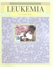 Cover of: Leukemia (Understanding Illness (Mankato, Minn.).) | 